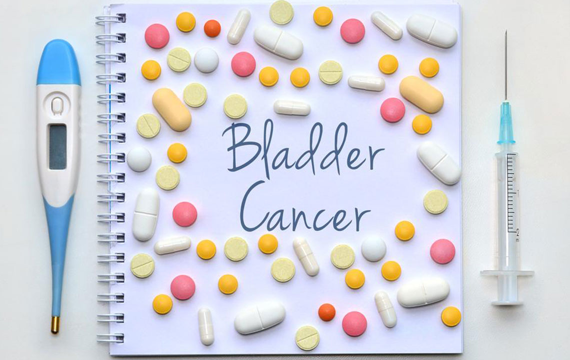 Things to know about the different stages of bladder cancer