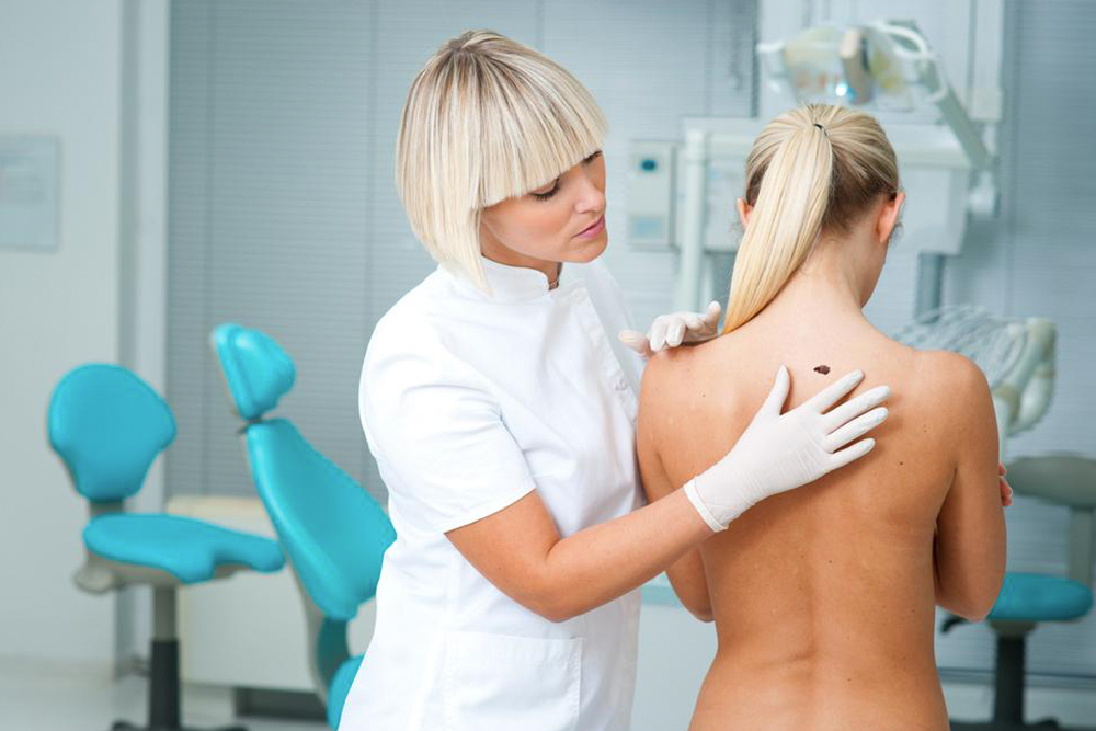Things you should know about stage four melanoma