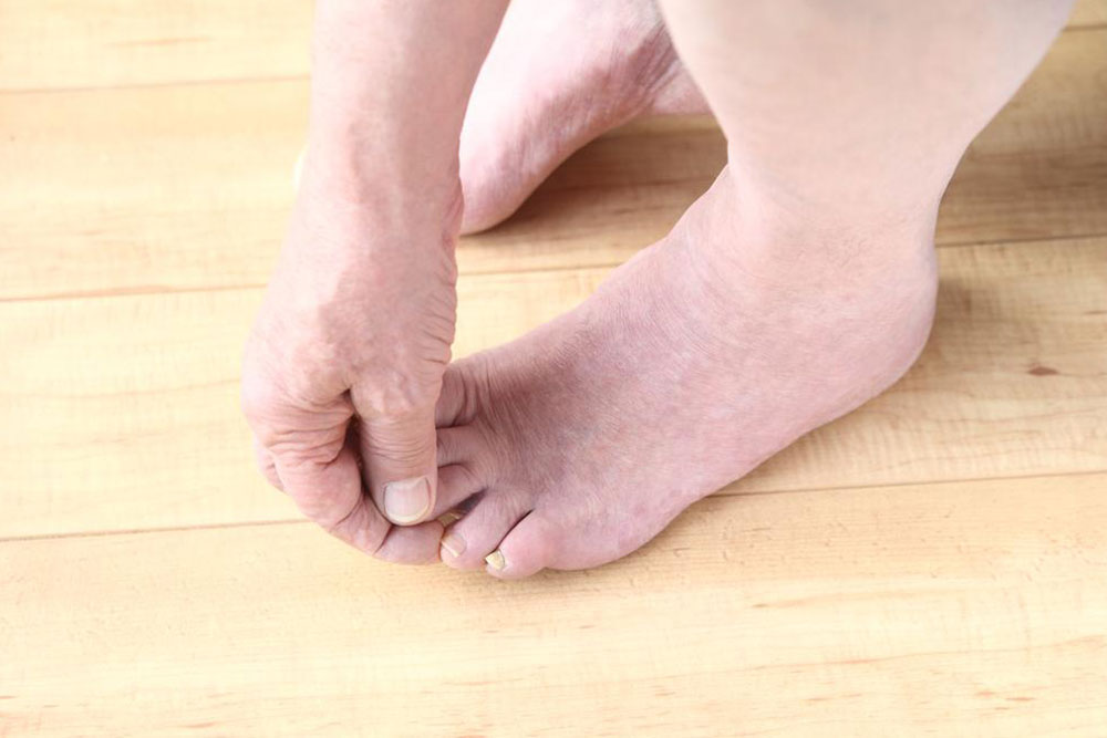 Important things to know about toenail fungus