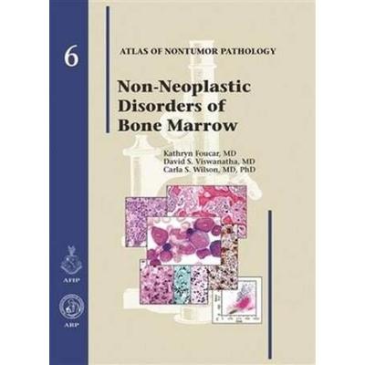 Atlas of Nontumor Pathology: Non-Neoplastic Disorders of Bone Marrow