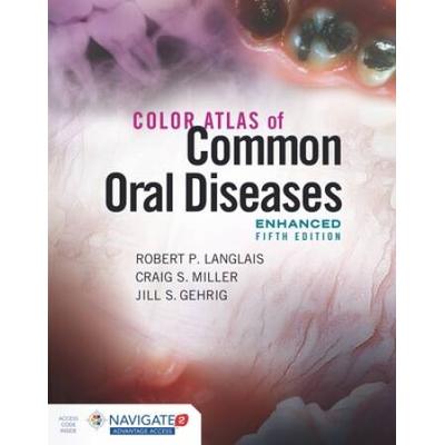 Color Atlas Of Common Oral Diseases