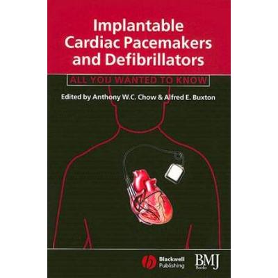 Implantable Cardiac Pacemakers And Defibrillators: All You Wanted To Know