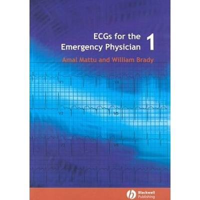 Ecgs For The Emergency Physician 1