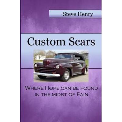 Custom Scars: Where Hope Can Be Found In The Midst Of Pain